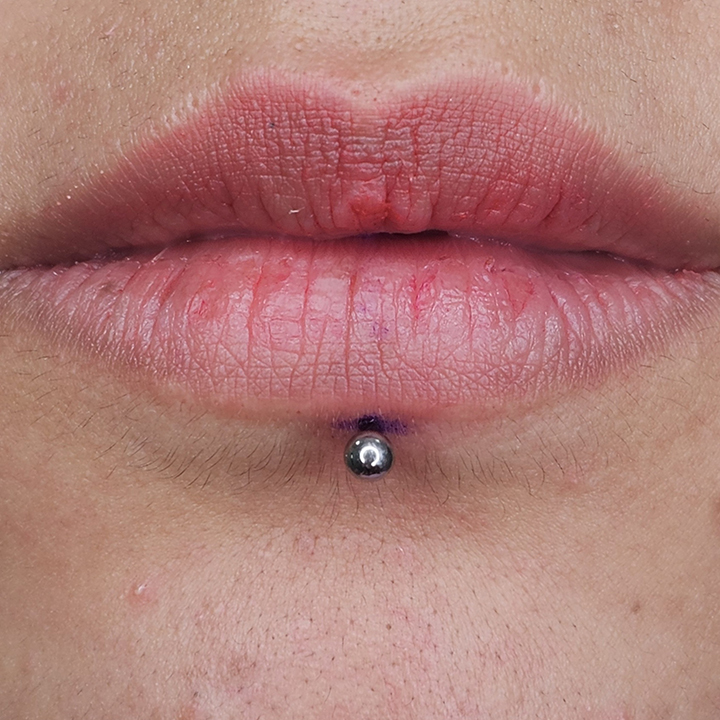 Close-up of a person's lips showing a fresh vertical labret piercing centered below the lower lip, with a silver ball-end stud.